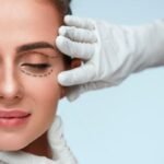 Mulher sendo examinada para blefaroplastia, com marcação ao redor dos olhos feita por profissional da área estética.