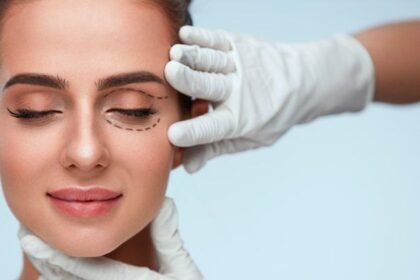 Mulher sendo examinada para blefaroplastia, com marcação ao redor dos olhos feita por profissional da área estética.